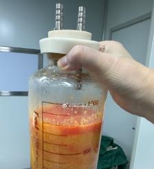 三亚水动力吸脂手术要做多久？